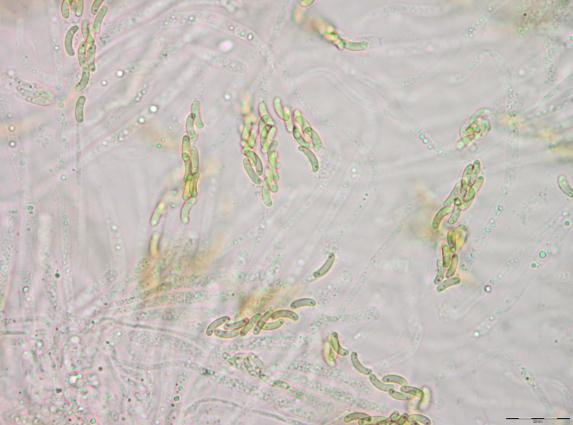 Stubbehornordenen: Eutypella cerviculata.