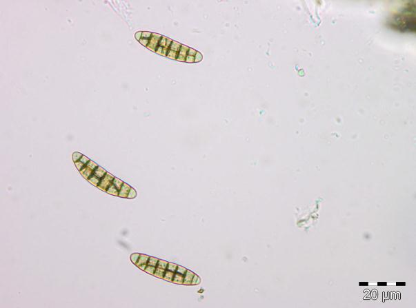 Soppriket: Gloniopsis.