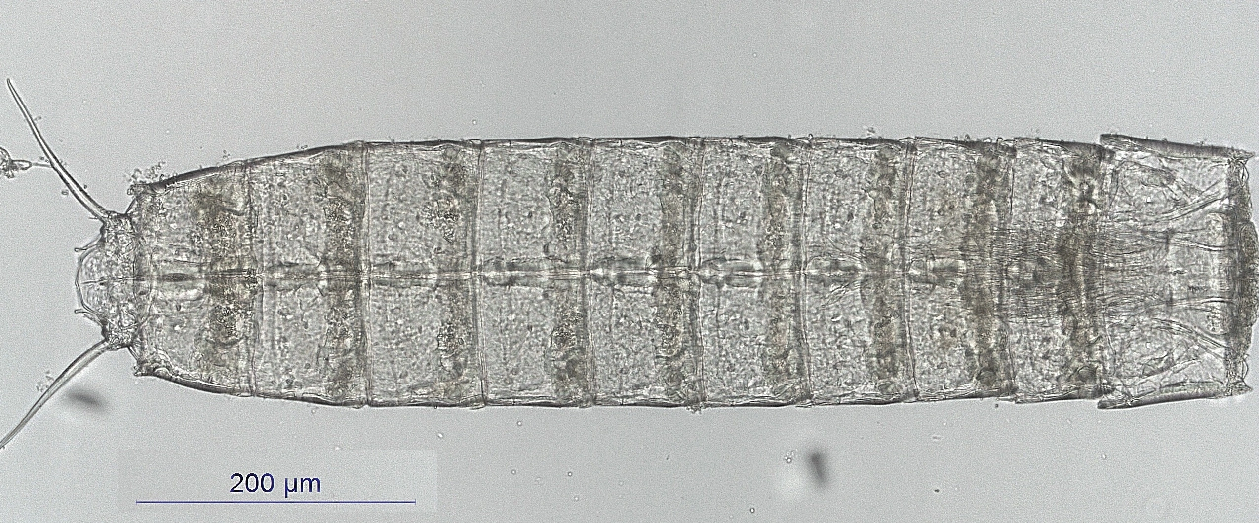 Cephalorhyncher: Pycnophyes zelinkaei.