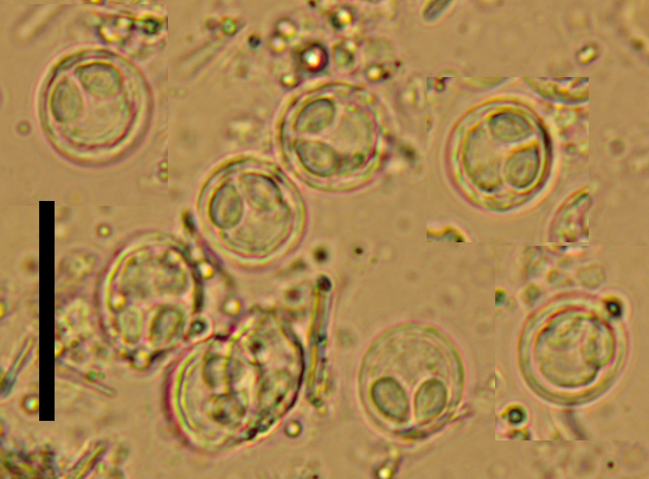 Slimsporedyr: Myxobolus aeglefini.