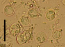 Slimsporedyr: Myxobolus aeglefini.