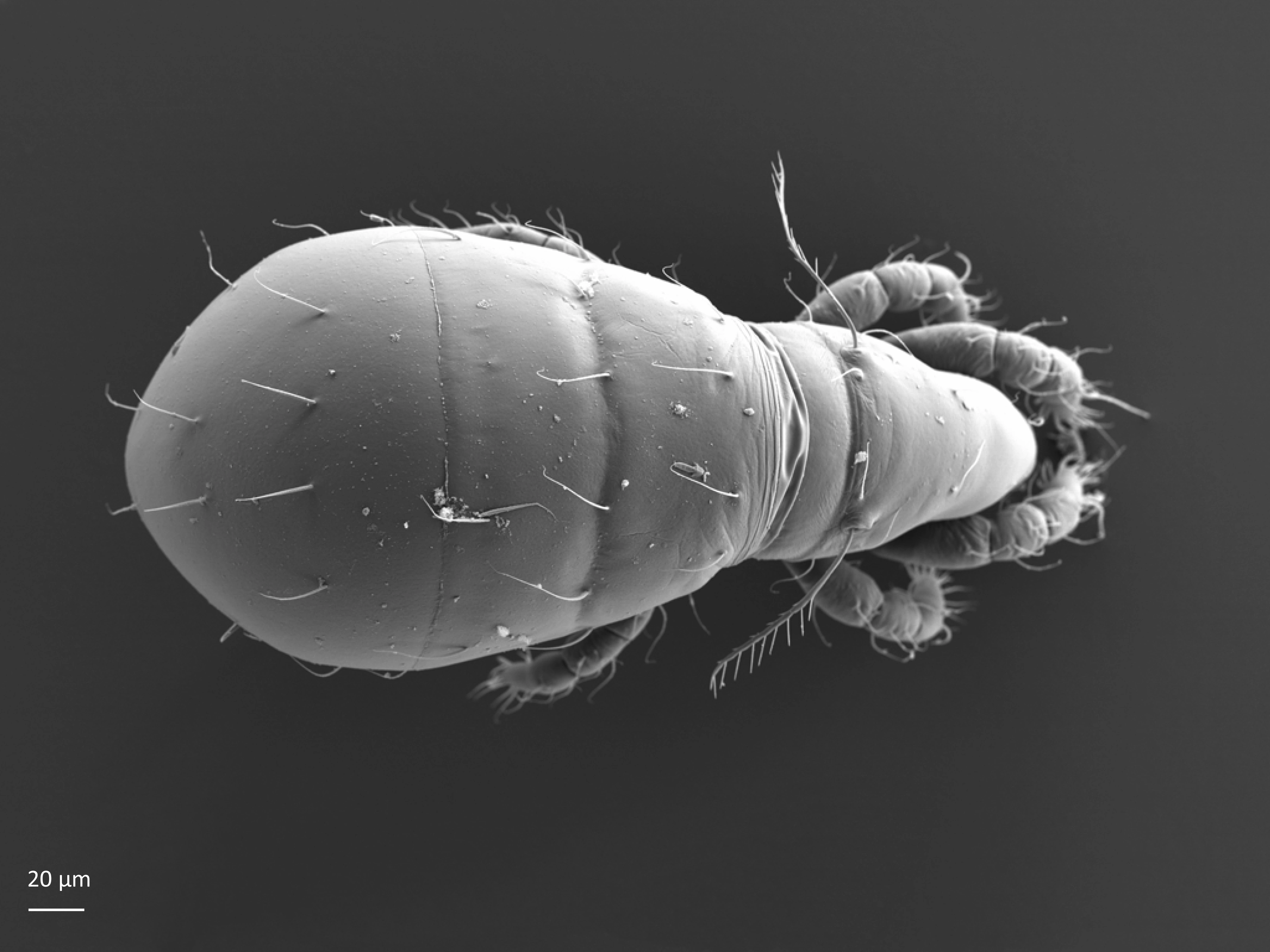 Midd: Eniochthonius minutissimus. Midd: Eniochthoniidae.