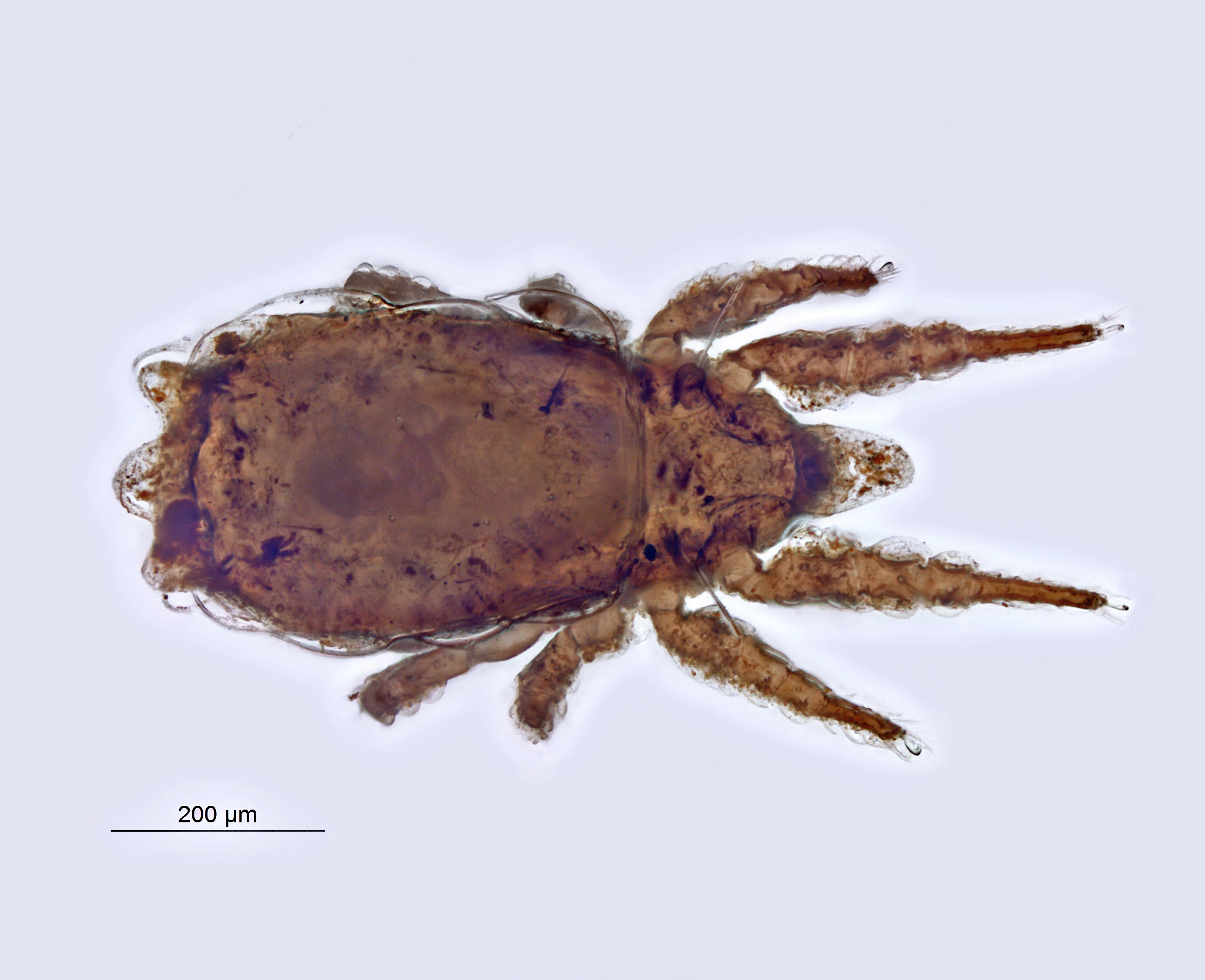 Midd: Heminothrus targionii.