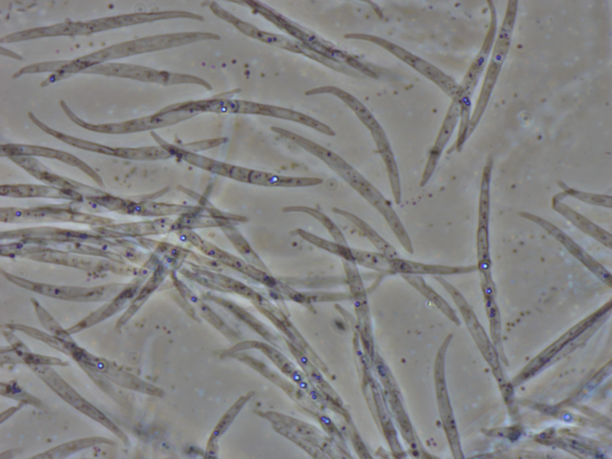 Sigdmuggsopper: Fusarium tricinctum.