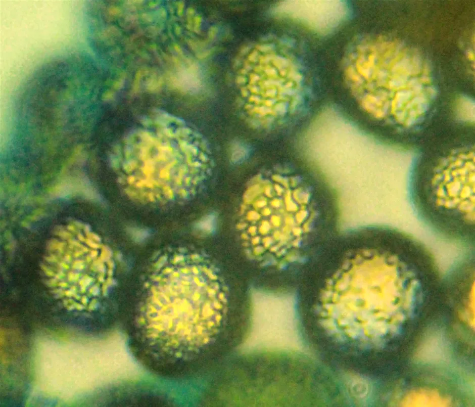 Gule, runde sporer med ruglete overflate hos slimsoppen Hemitrichia decipiens
