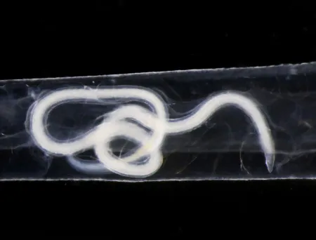 Hysterothylacium aduncum (Rudolphi, 1802) Deardorff & Overstreet, 1981