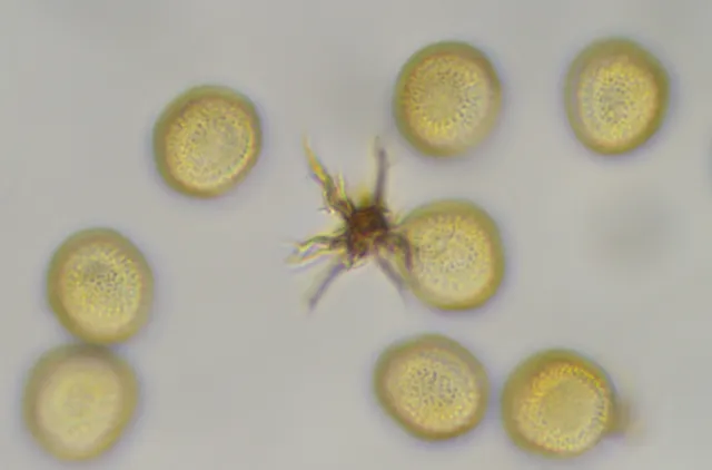 Sporer (og en kort elater) hos slimsoppen Trichia longipalpis