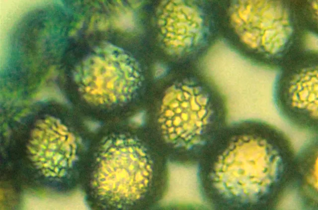 Gule, runde sporer med ruglete overflate hos slimsoppen Hemitrichia decipiens