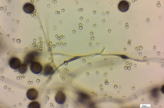 Små, runde, brune sporer hos slimsoppen Diderma alpinum og enda mindre, gjennomsiktige kalkkorn