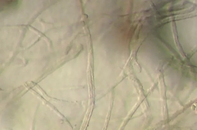 Grå streker på kryss og tvers som viser kapillitium hos slimsoppen Diderma asteroides