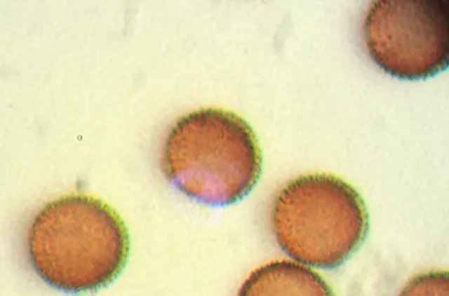 Brune runde sporer hos slimsoppen Diderma asteroides.