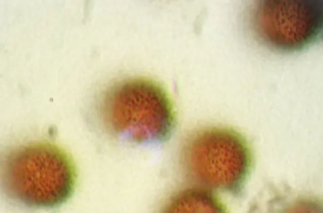 Brune runde sporer hos slimsoppen Diderma asteroides.