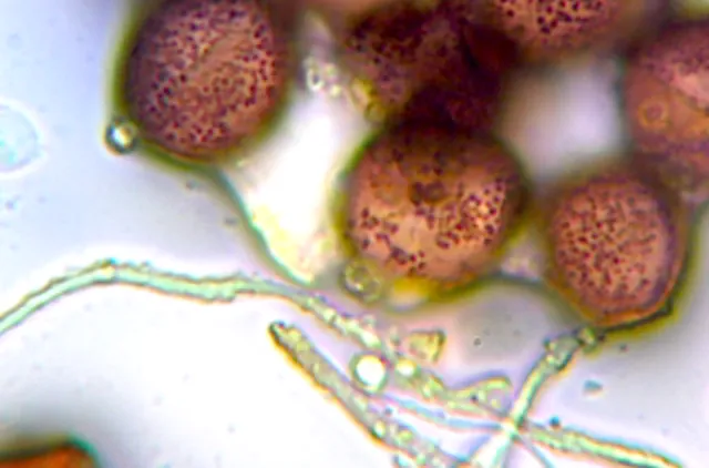 Brune, runde sporer og trådformede, gjennomsiktige kapillitium hos slimsoppen Diderma asteroides.