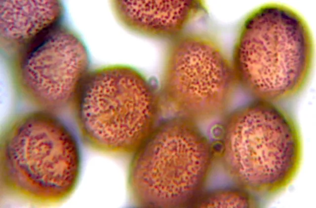 11 brune, runde sporer til slimsoppen Diderma asteroides.