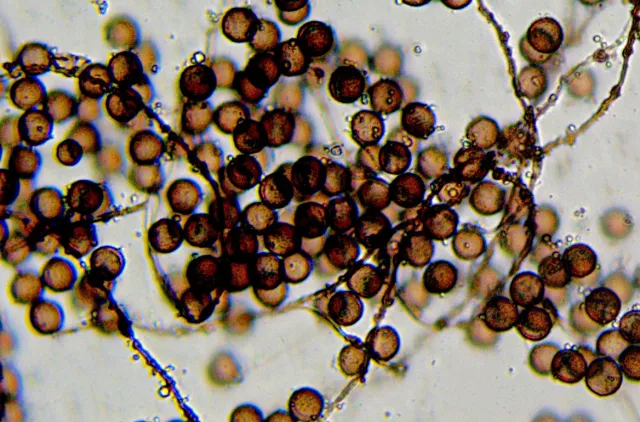 Mikroskopbilde av mange runde, brune prikker (sporer)