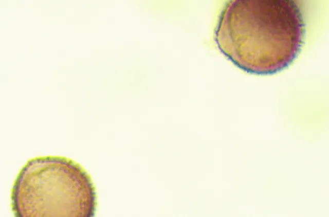 Mikroskopbilde av to runde, lys brune sporer.