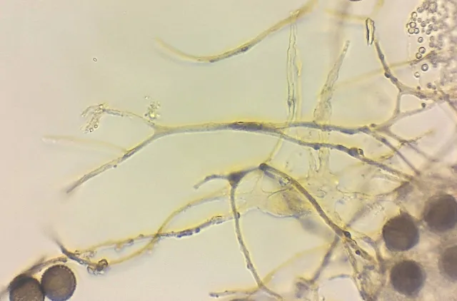 Mikroskopbilde av noen runde, brune sporer og lange trådaktige kapillitium