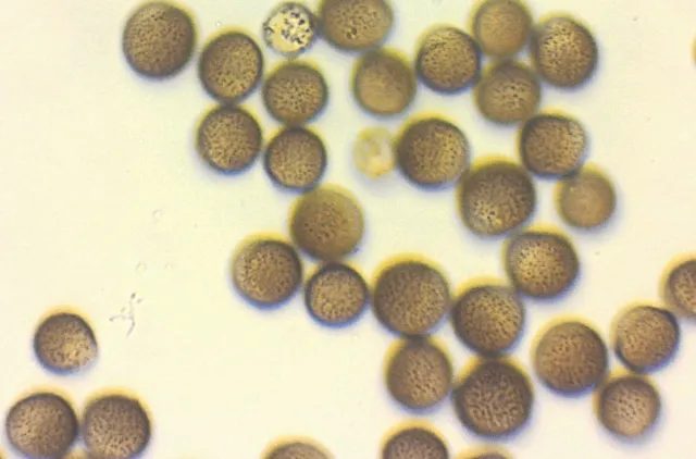Mikroskopbilde av et tjuetalls brune, runde sporer.