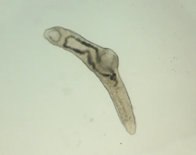 Derogenes varicus (Müller, 1784) Looss, 1901