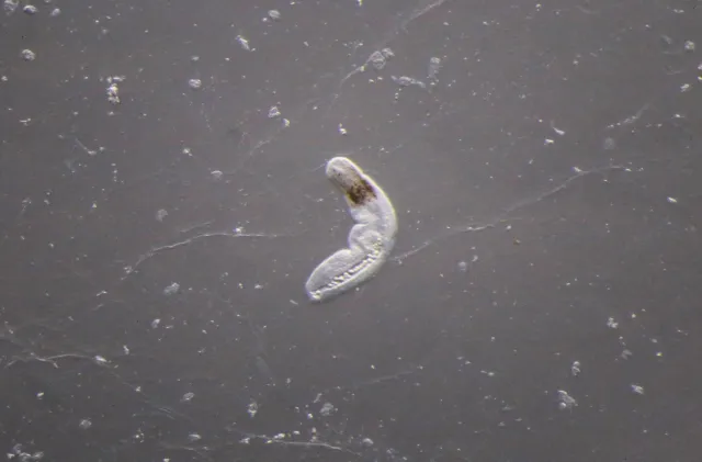 Opechona bacillaris (Molin, 1859) Dollfus, 1927